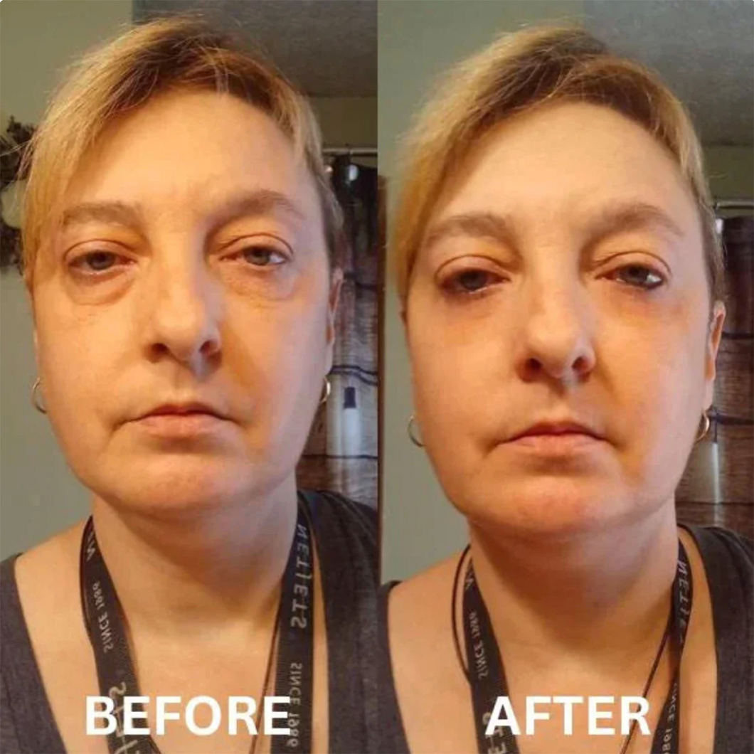 8x InstaLift Collagen Eye Patches