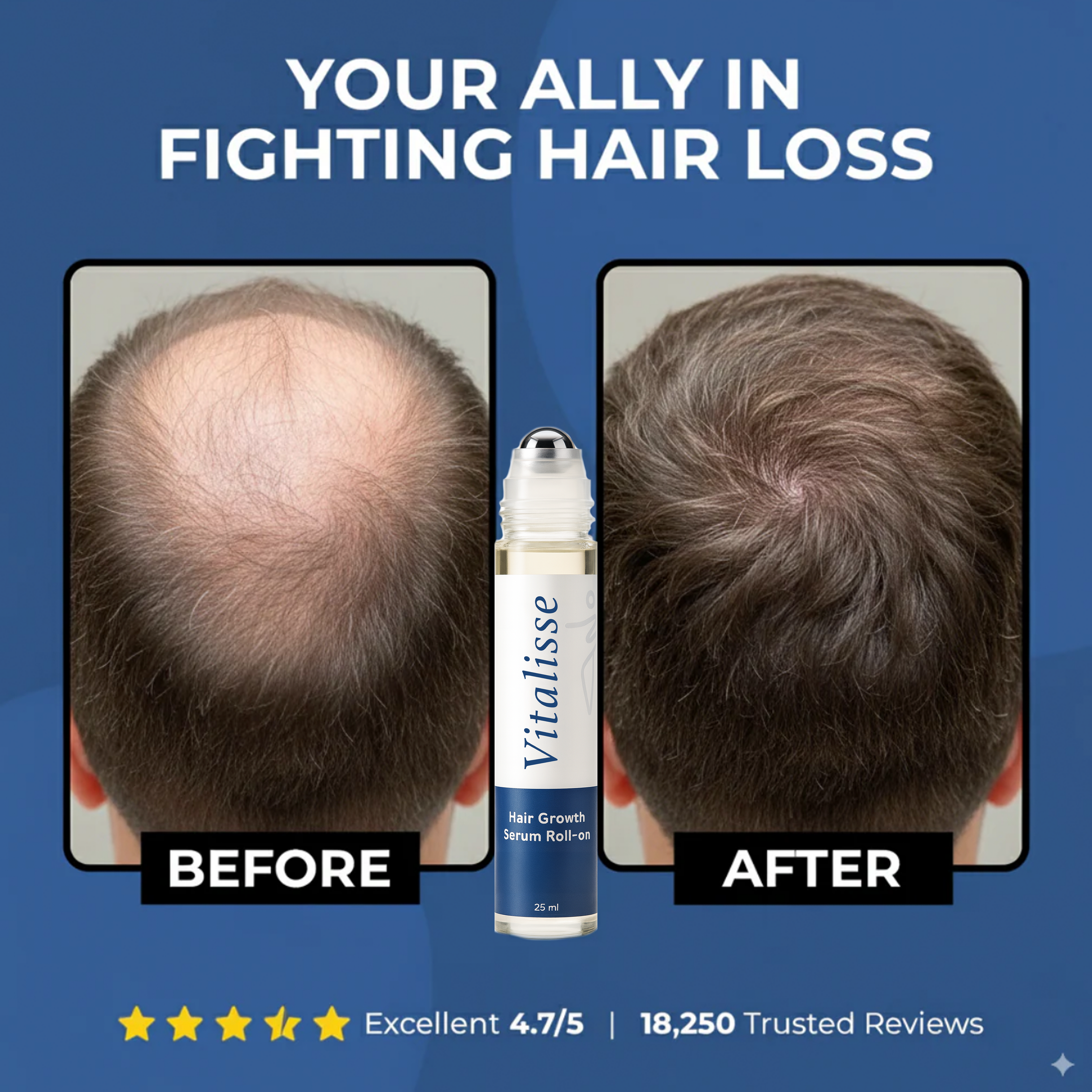 Advanced Roll-on Hair Growth Serum