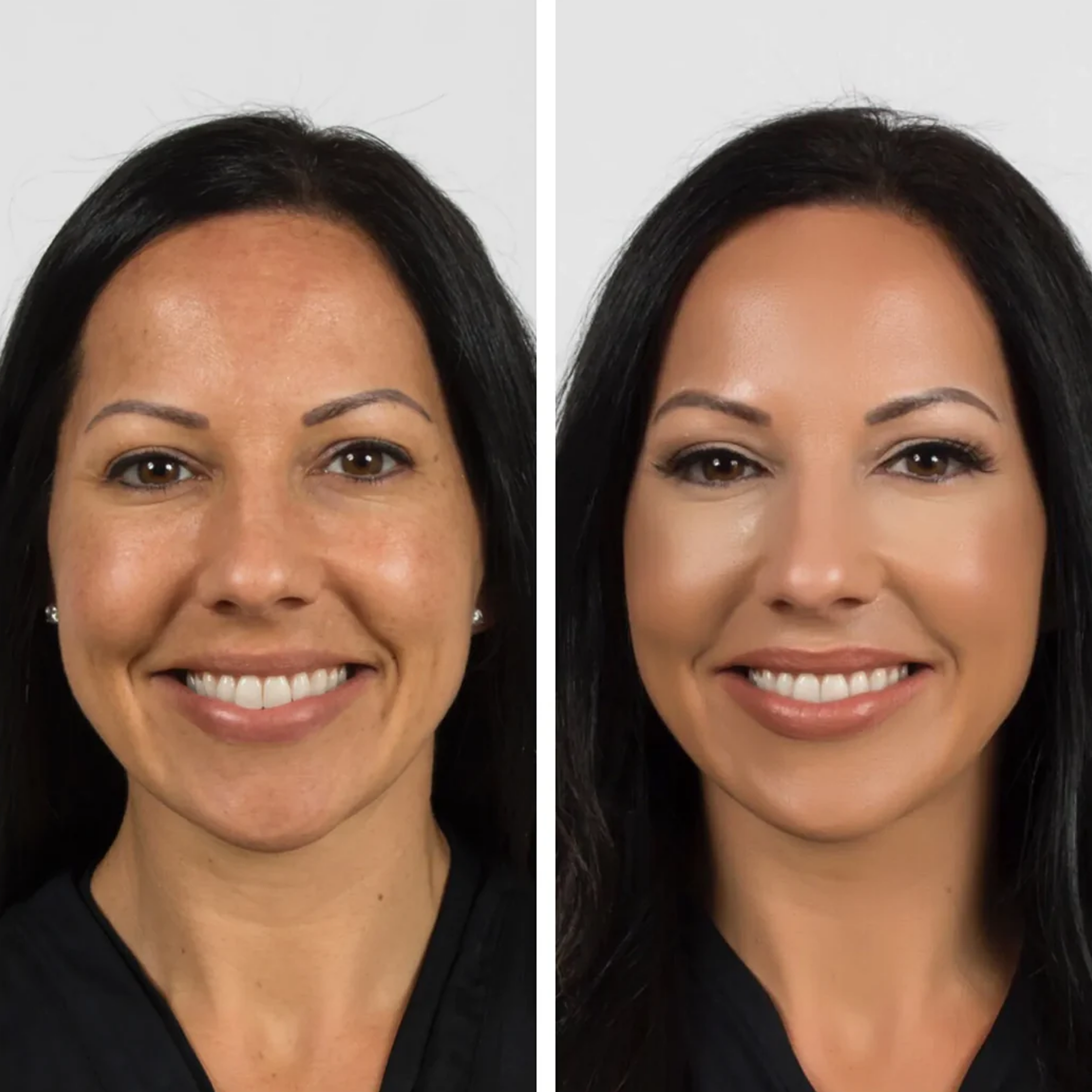 Vitalisse™ Medium-to-Light Magic Foundation