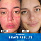 Ocean's Miracle - Natural Healing Cream