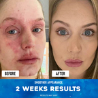 Ocean's Miracle - Natural Healing Cream