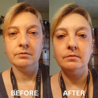 8x InstaLift Collagen Eye Patches