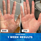 Ocean's Miracle - Natural Healing Cream