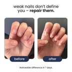 Nail Rejuvenation Serum