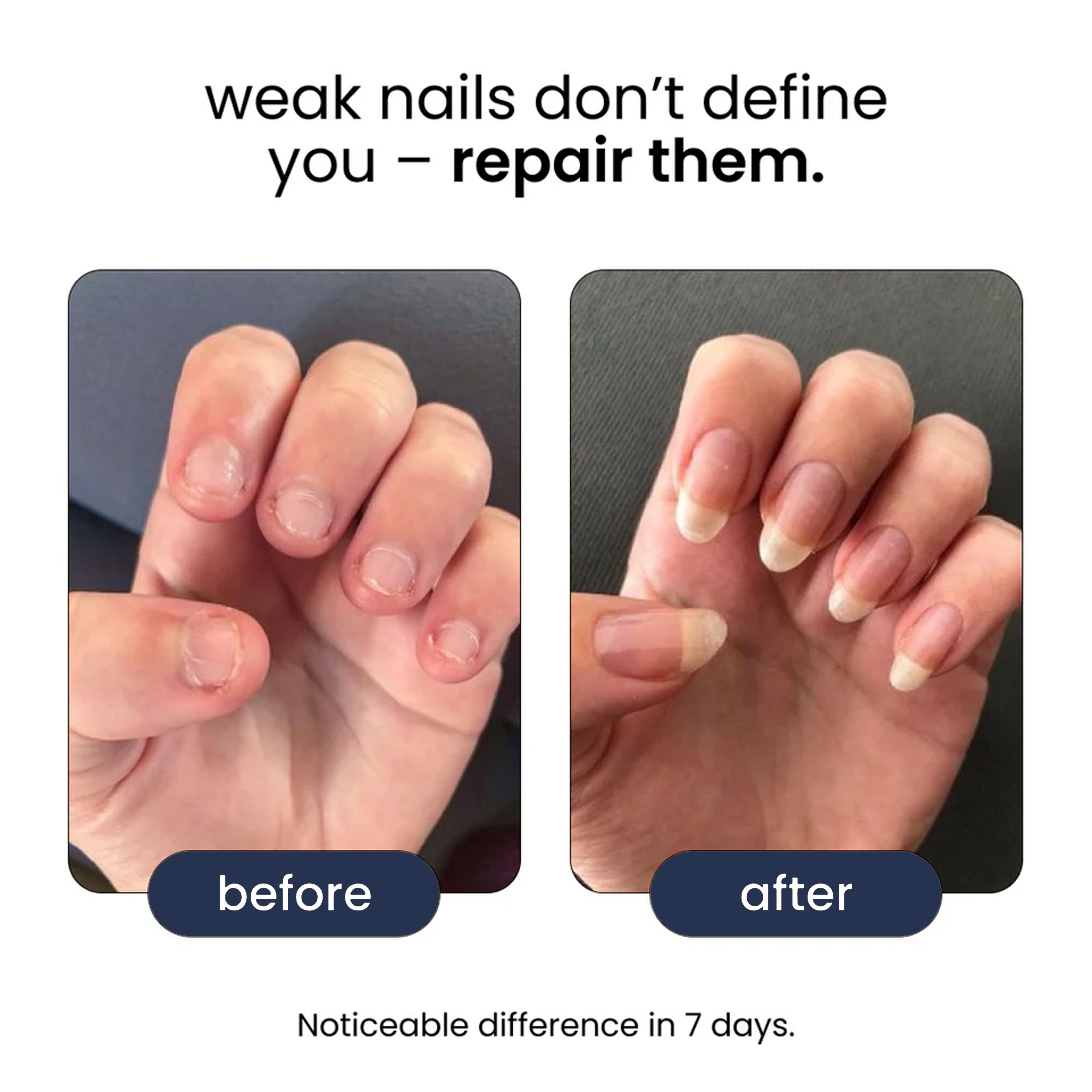 Nail Rejuvenation Serum