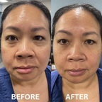 8x InstaLift Collagen Eye Patches