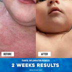 Ocean's Miracle - Natural Healing Cream