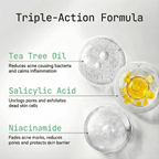 24h Acne Drying Lotion