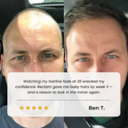 Advanced Roll-on Hair Growth Serum